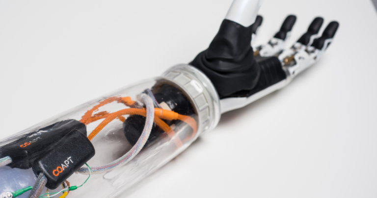 The Latest Prostheses Take Orders Directly From Your Nerves