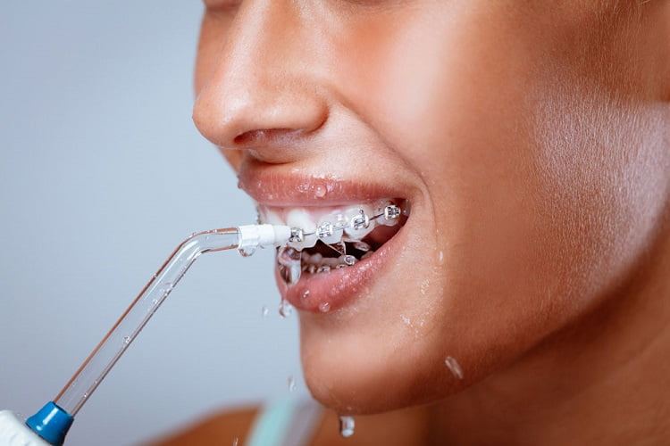A woman with braces flossing her teeth using a Water flosser